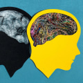 The Complex Causes of Bipolar Depression